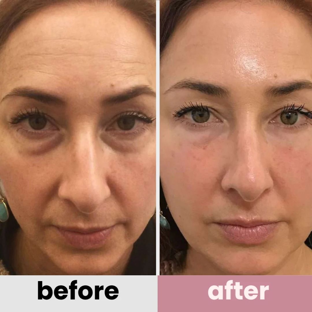 Korean Retinol Under Eye Balm