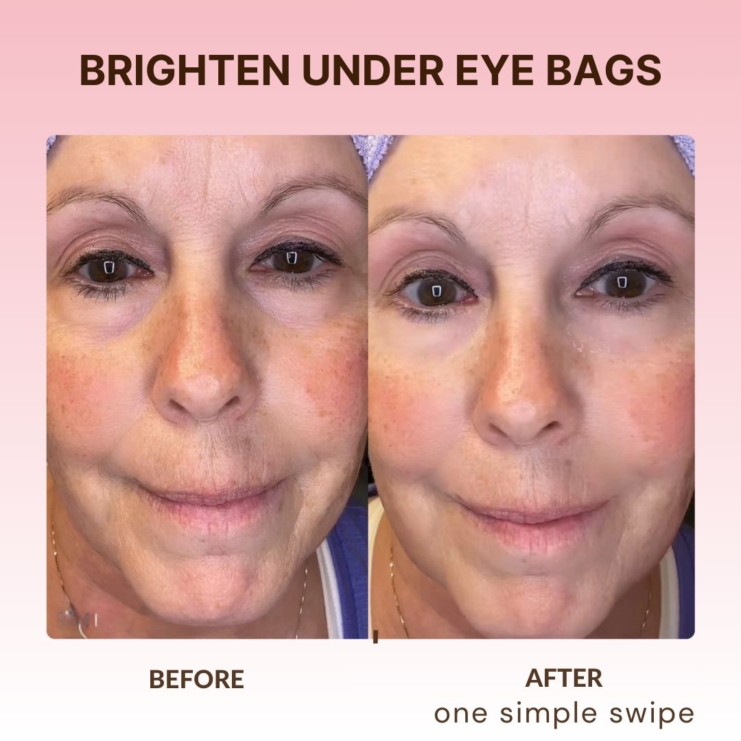 Korean Retinol Under Eye Balm