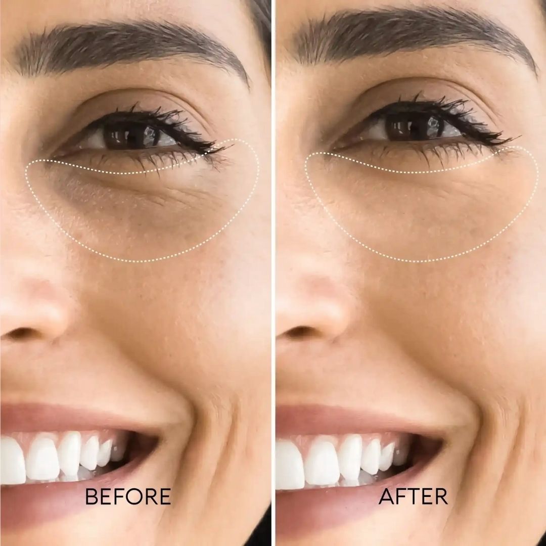 Korean Retinol Under Eye Balm