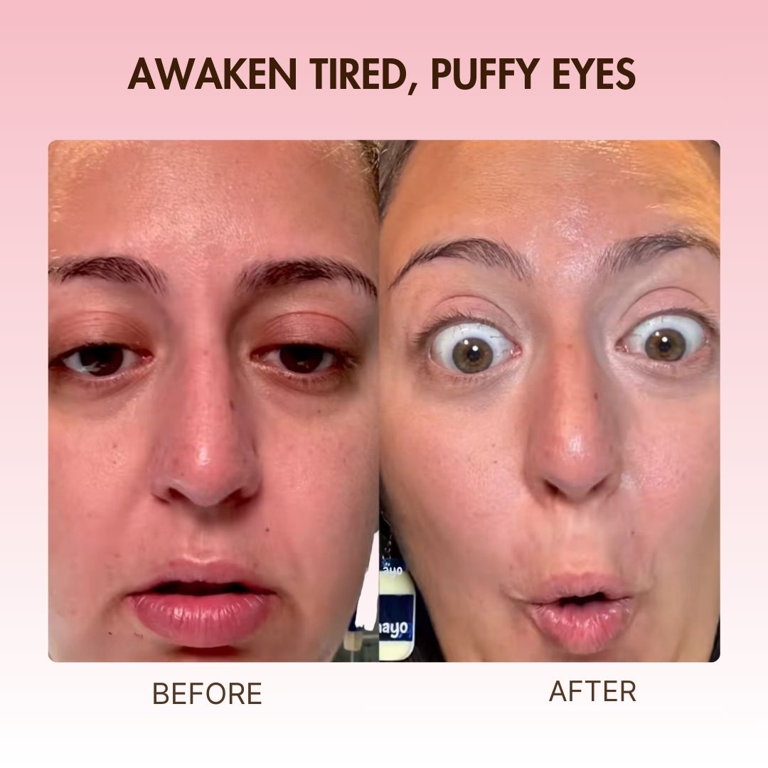 BodyLove - Instant Eye Lift