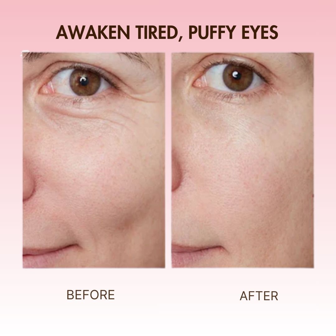 BodyLove - Instant Eye Lift