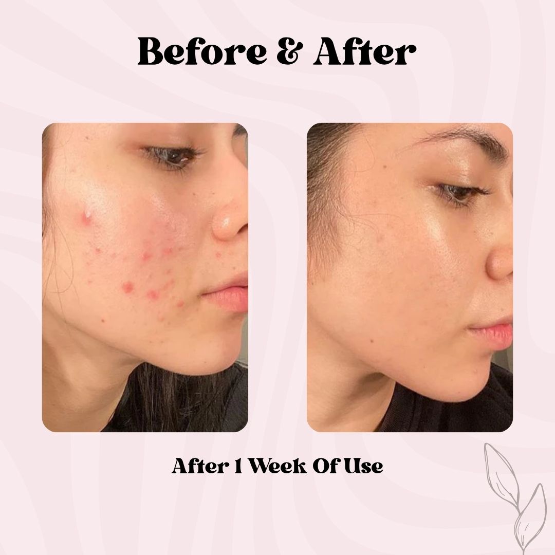 Deep Collagen Retinol Tension Boost-Up Mask