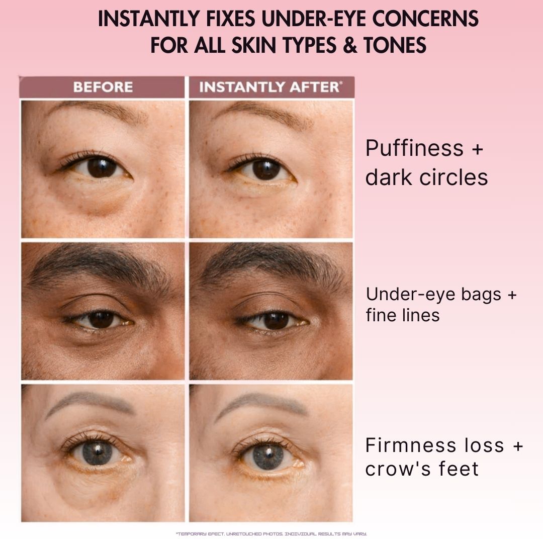 BodyLove - Instant Eye Lift