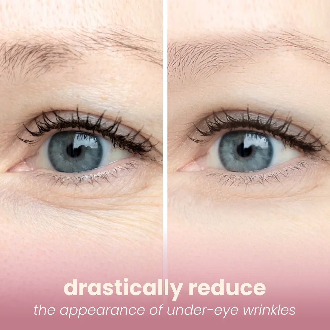 DermaFuse Patches