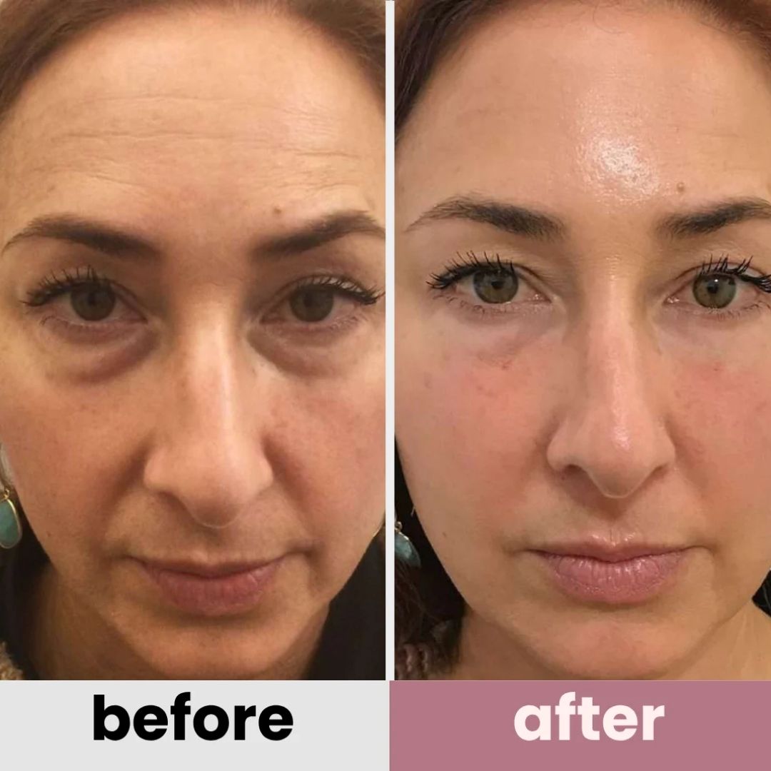 DermaFuse Patches