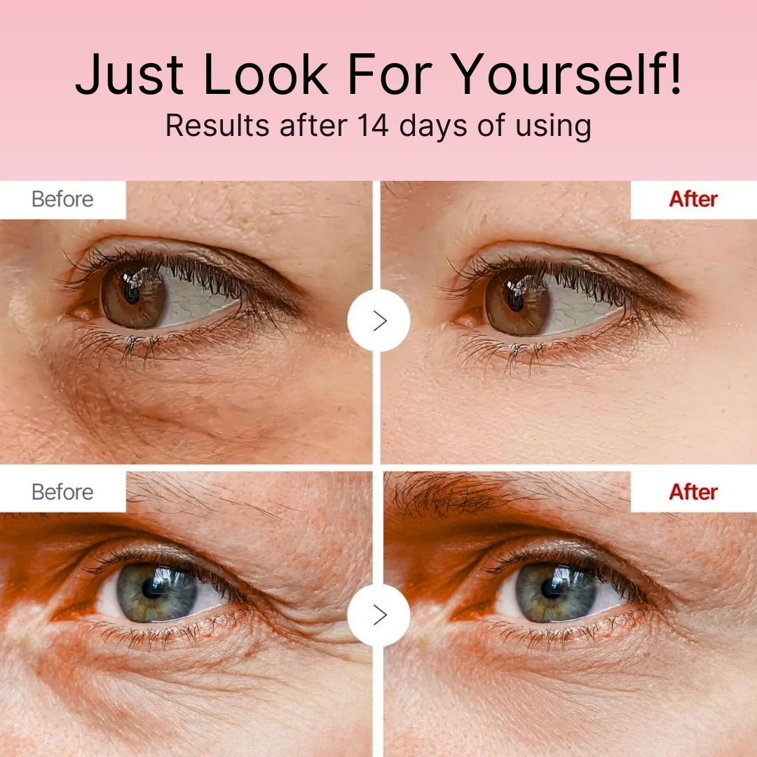 Korean Retinol Under Eye Balm