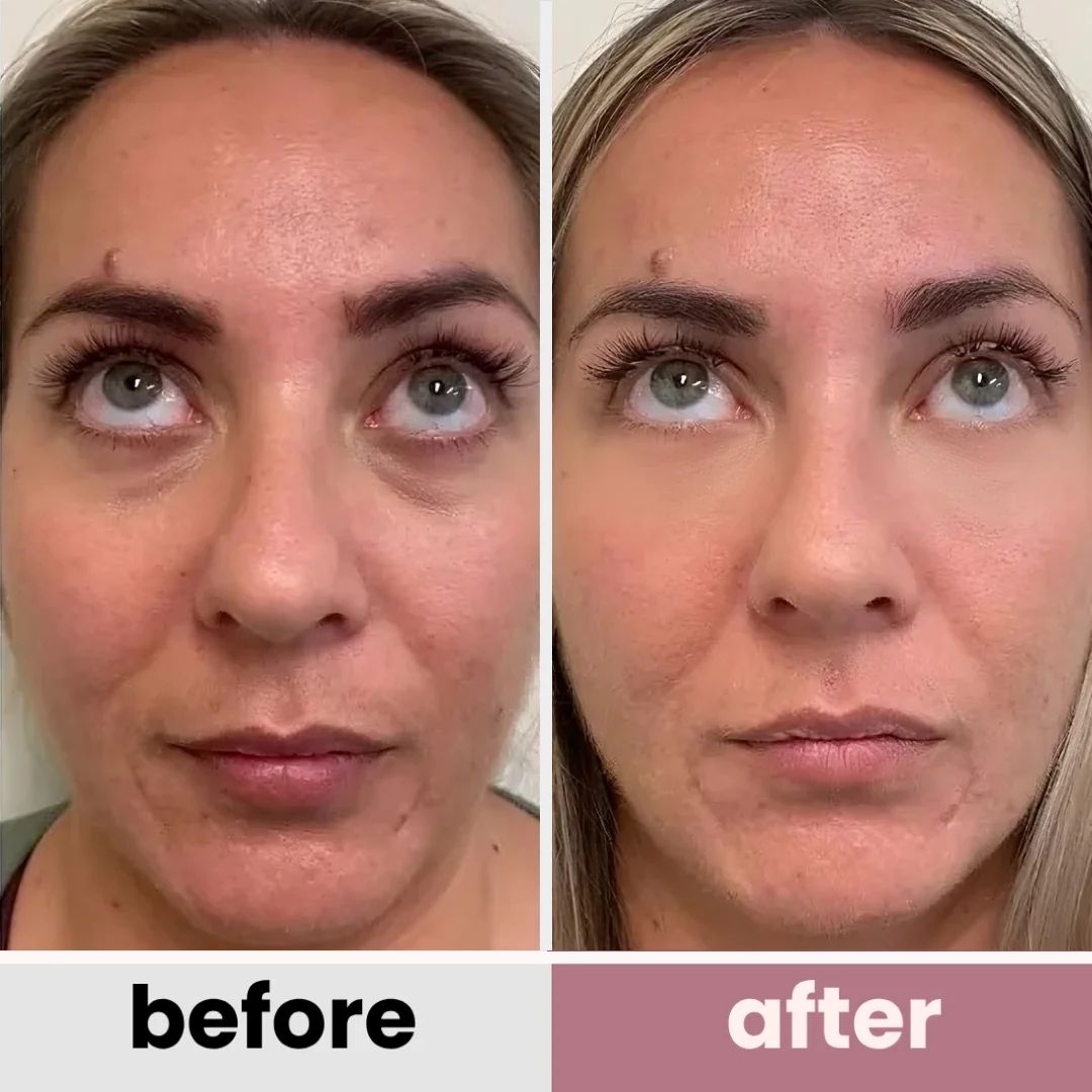 DermaFuse Patches