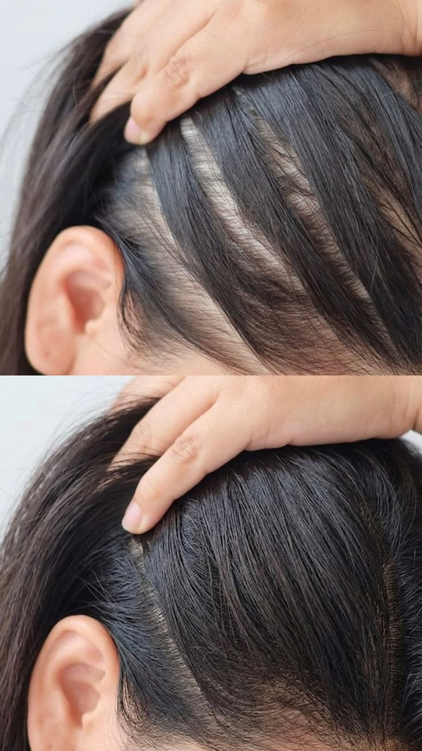 Narrower parting and a fuller looking crown
