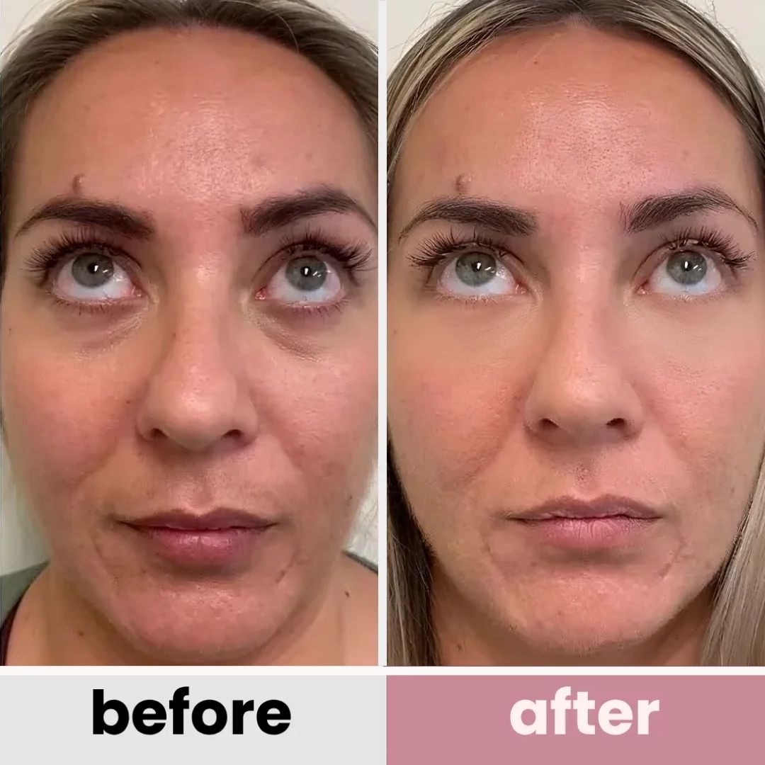 PDRN Pink Peptide Eye Cream