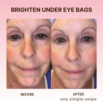 Korean Retinol Under Eye Balm