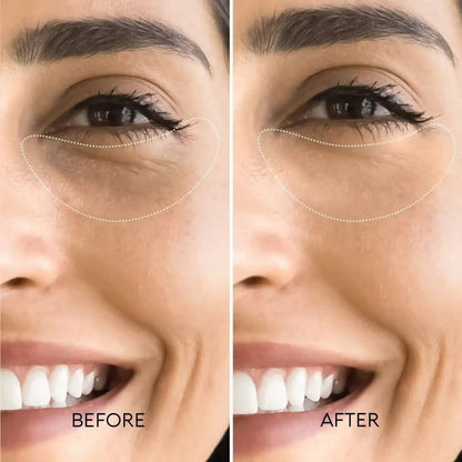 Korean Retinol Under Eye Balm