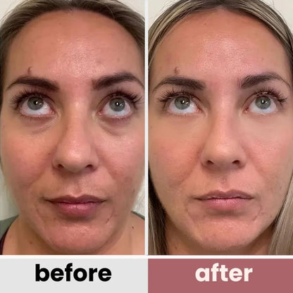 No.9 NAD+ Retinol Eye-lift Cream