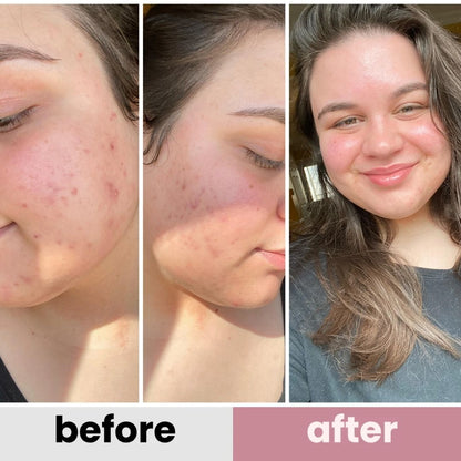 No.9 NAD+ BIO Lifting-sil Essence