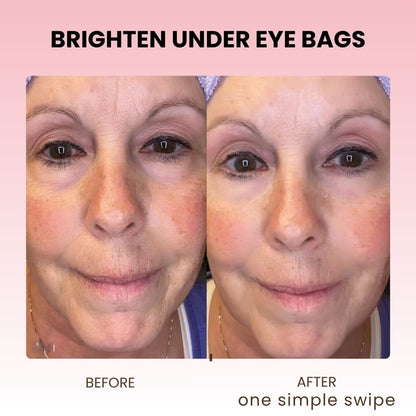 No.9 NAD+ Retinol Eye-lift Cream