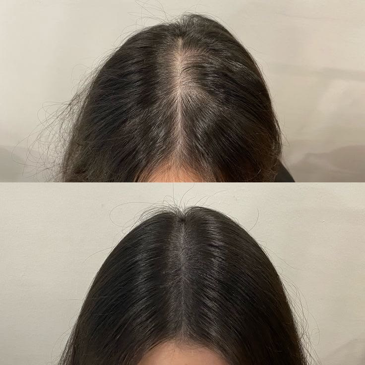 Instant scalp comfort and cooling relief