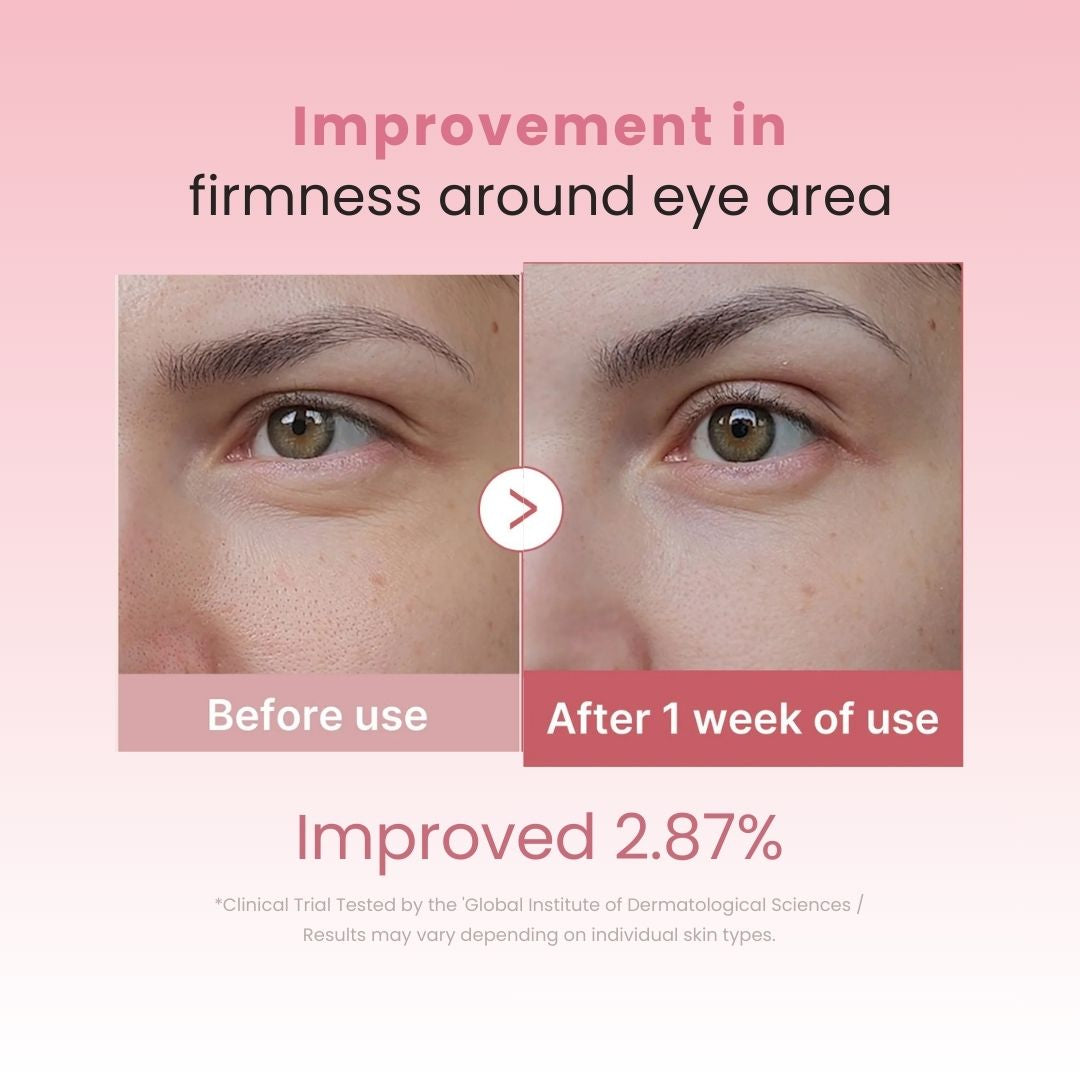 PDRN Pink Peptide Eye Cream