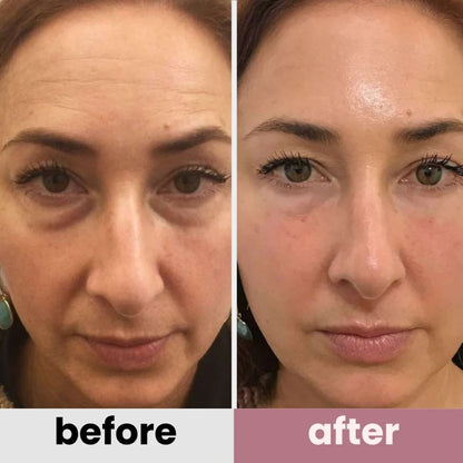 DermaFuse Patches