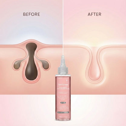 Blackhead Melting Softner