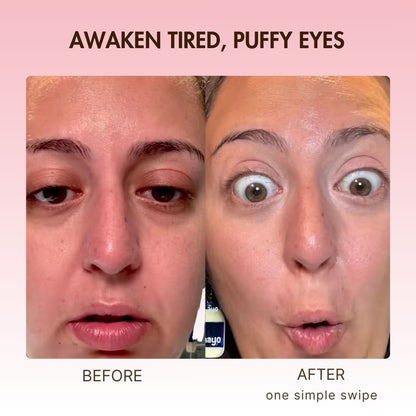 Korean Retinol Under Eye Balm