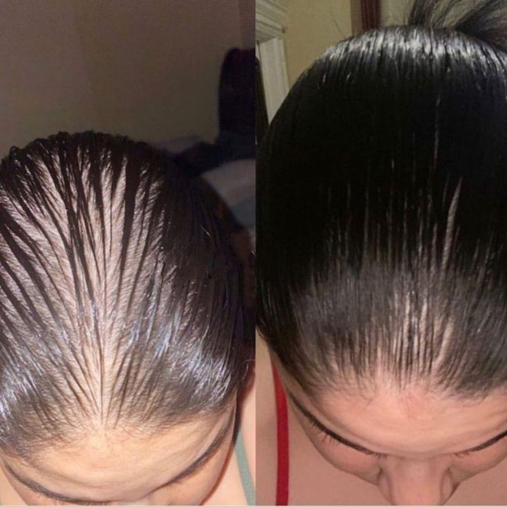 Narrower parting and a fuller looking crown