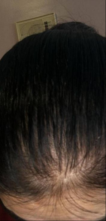 After