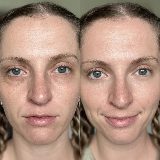 PDRN Pink Peptide Eye Cream