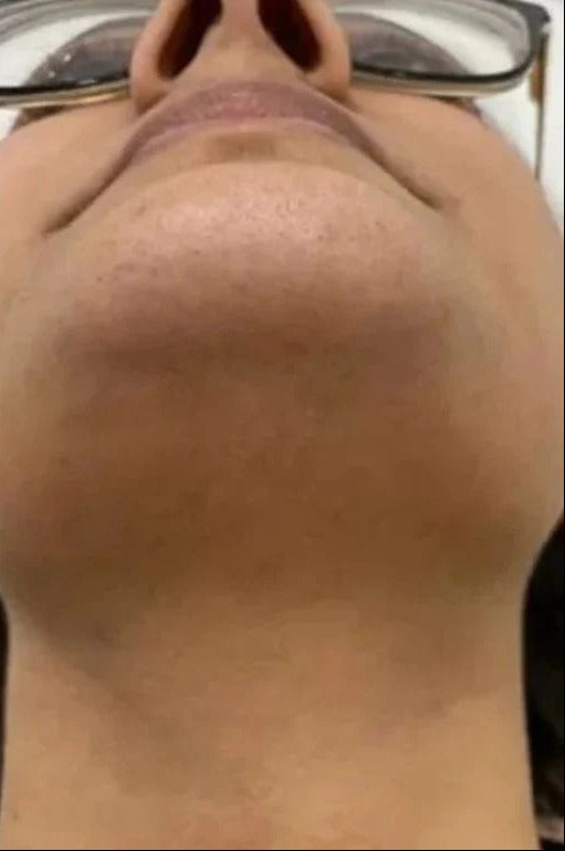 After