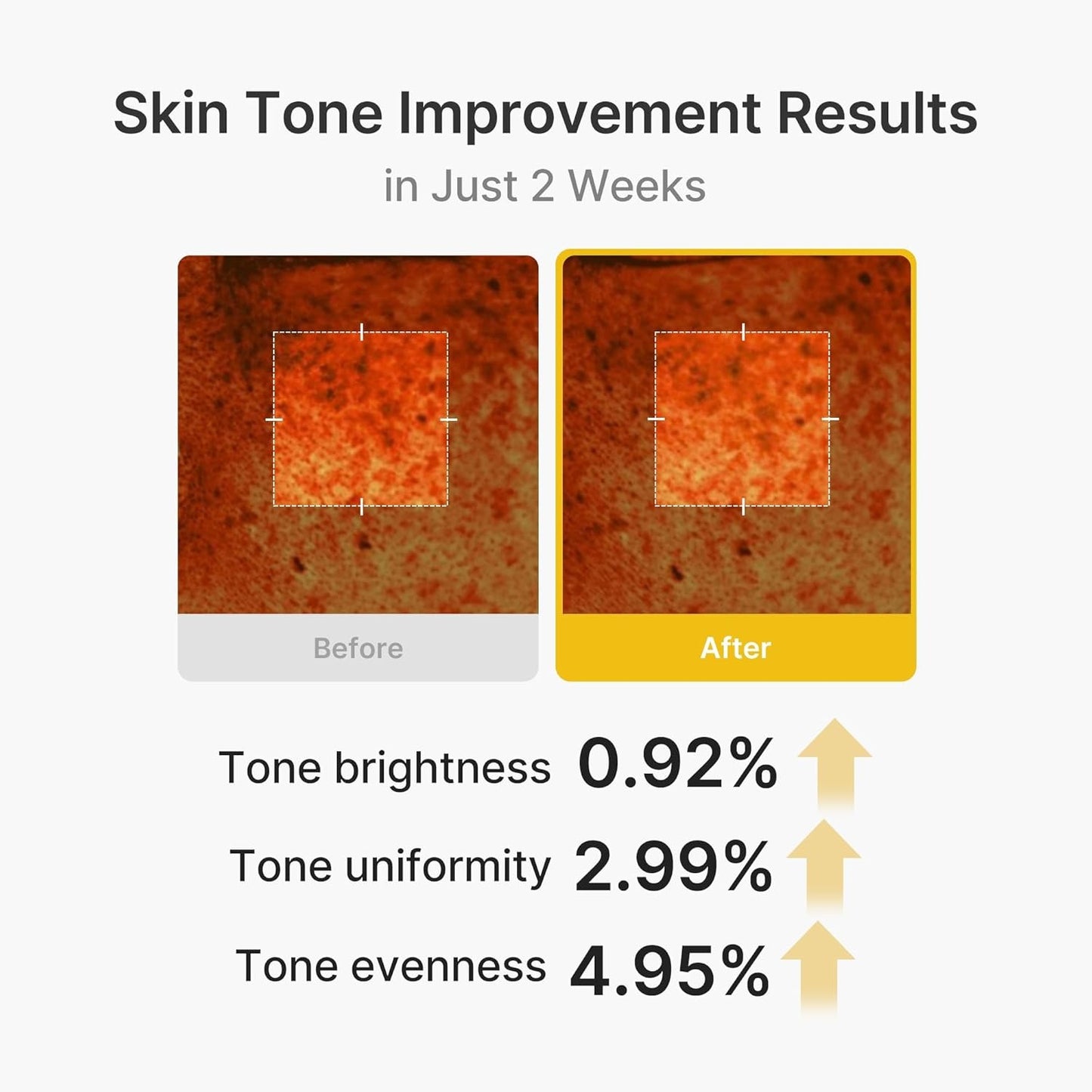 Korean  Kojic Glow Capsule Cream