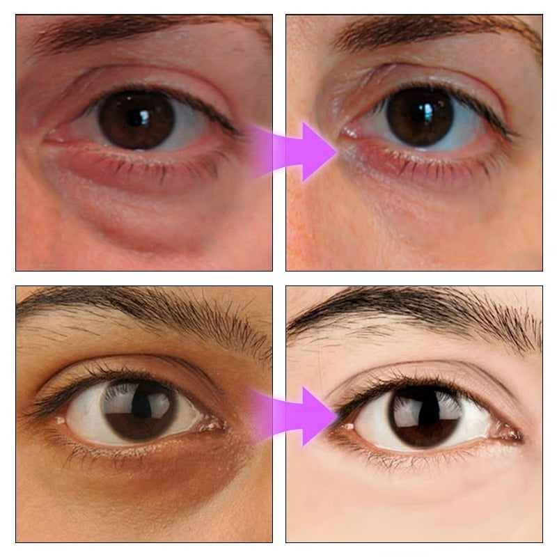 PDRN Pink Peptide Eye Cream